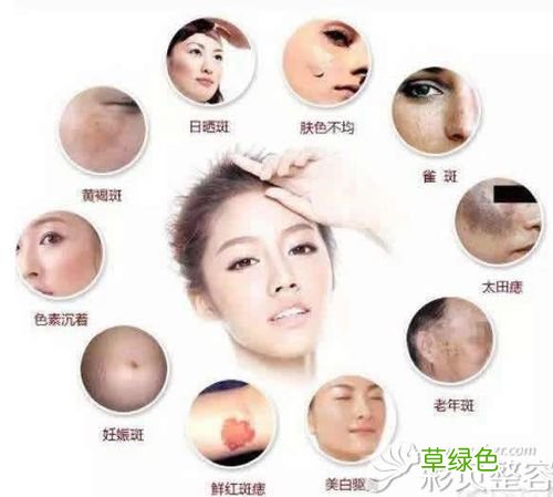 去黄褐斑方法是什么 去黄褐斑方法