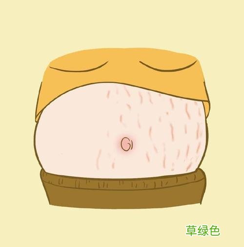 如何去除妊娠纹和肥胖纹 如何去除妊娠纹