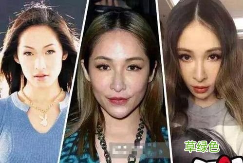 求职被打玻尿酸