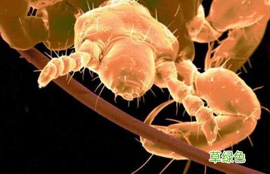 虱子怎么去除最快方法不剪头发 虱子怎么去除