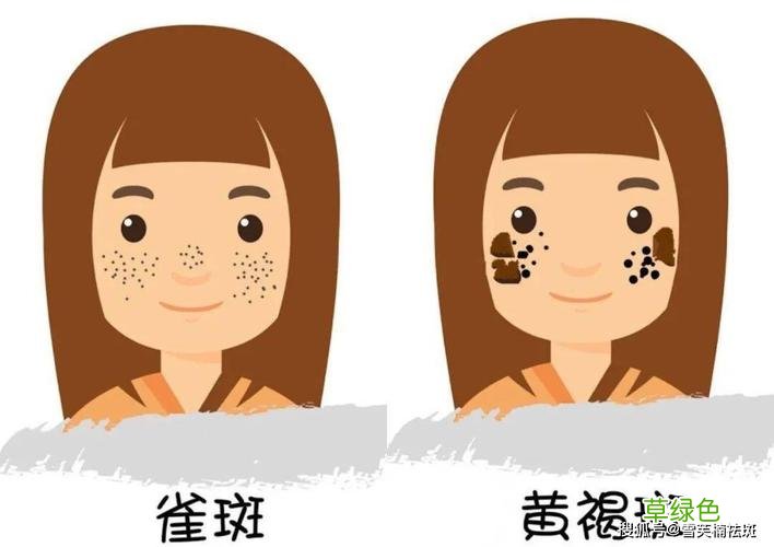 土豆祛斑的小窍门 美容祛斑小窍门