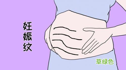妊娠纹用什么方法可以去除掉 妊娠纹怎么预防