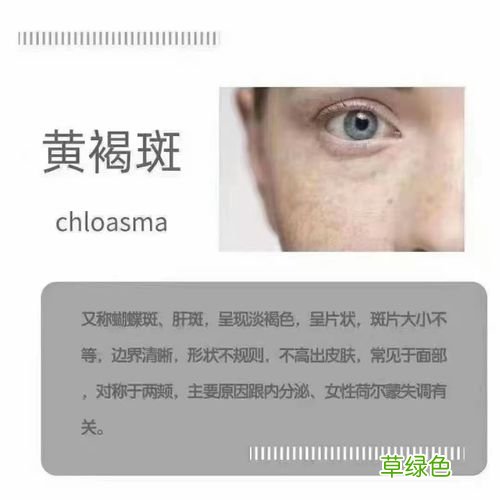 点状色斑怎样形成的 色斑是怎样形成的