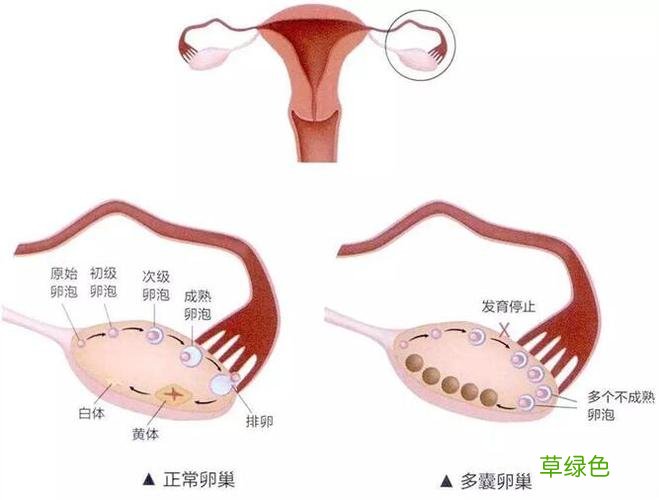 女性卵巢保养方法 女性卵巢保养