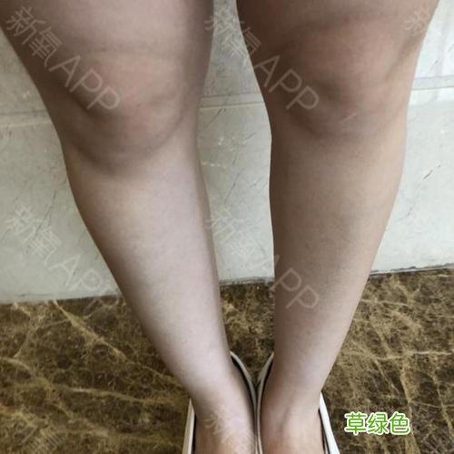 激光脱毛多久一次合适 女性激光脱毛