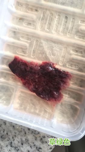 药流和人流哪个恢复快 人流和药流哪个好