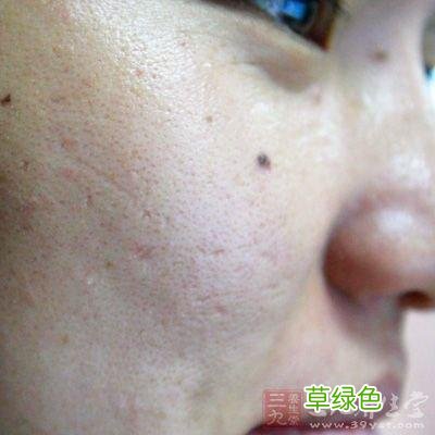 皮肤看着很粗糙怎么办 皮肤很粗糙怎么办
