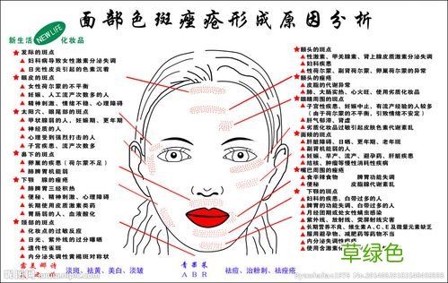 色斑形成原因图片高清图 色斑形成原因