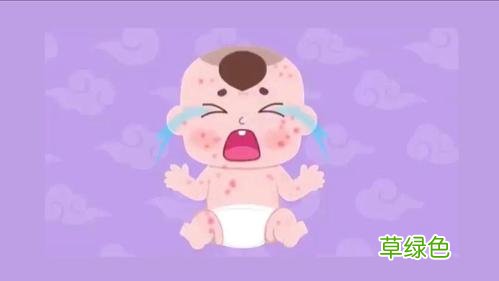 身上长瘊子怎么治疗 起痱子怎么办