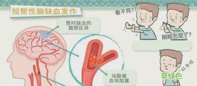 脑梗常见症状 脑干梗塞症状