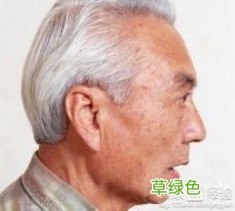 如何预防老年斑的生成 如何预防老年斑