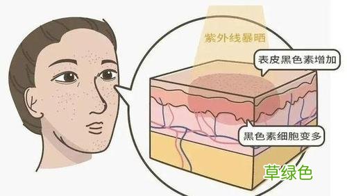 去斑点的最好方法 如何正确祛斑