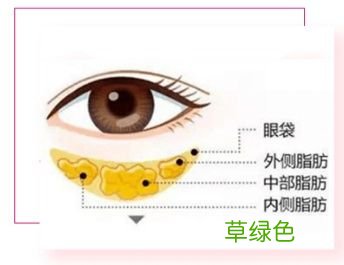 眼袋是怎么产生的 如何消除眼袋 如何消除眼袋