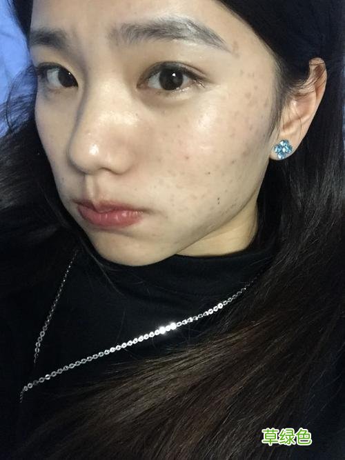 怎么才能去掉脸上的斑 如何去脸上的斑