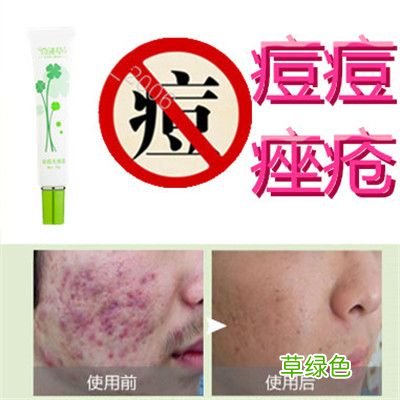 青春痘怎么去除 青春痘怎样去除