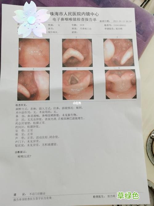 嗓子有痰咳不出来咽不下去怎么办 嗓子有痰咳不出