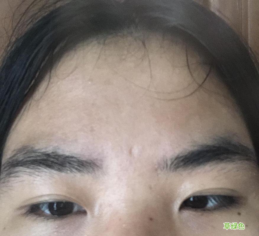 眉毛稀疏怎么办男生 眉毛稀疏怎么办