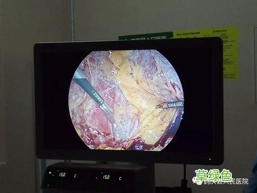 肾有囊肿怎么治 肾囊肿怎样治疗