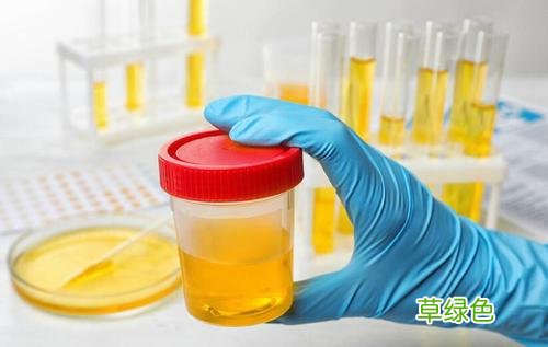 尿蛋白能彻底治愈吗 如何治疗尿蛋白
