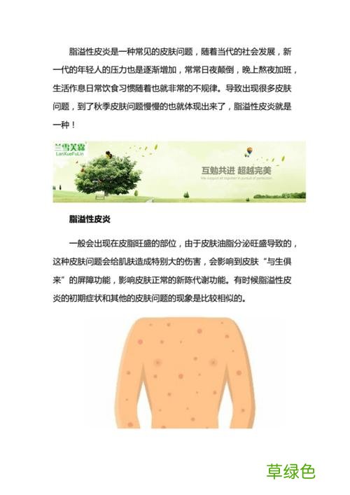 头皮脂溢性皮炎是什么 什么是脂溢性皮炎