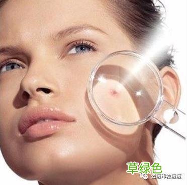 美白最快最有效的方法 皮肤快速美白