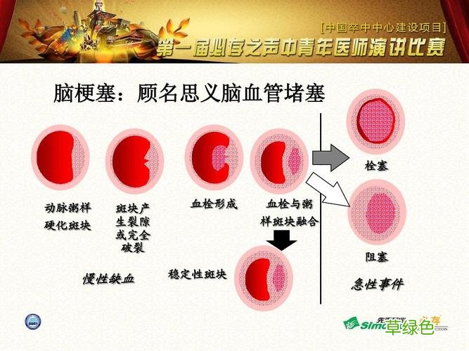 煤气中毒脑梗能治好么 脑梗能治好么