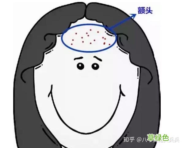 如何快速去痘痘 如何快速去痘