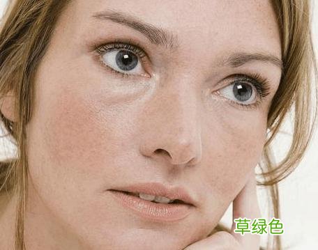 怎么祛除黄褐斑最有效 如何消除黄褐斑