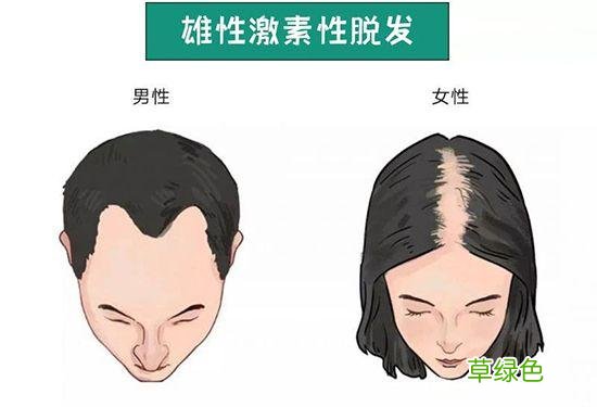 年轻人为什么会掉头发 年轻人脱发原因