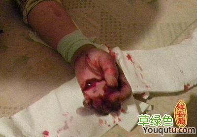 女人梦见耳朵流血 梦见耳朵出血