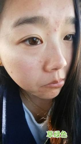 脸上皮肤不好怎么改善 皮肤差怎么改善