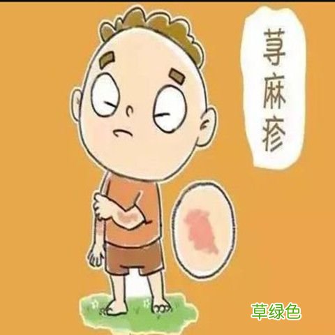 胆碱能行荨麻疹吃枸地氯雷他定片,还是氯雷他定片好 胆碱能行荨麻疹