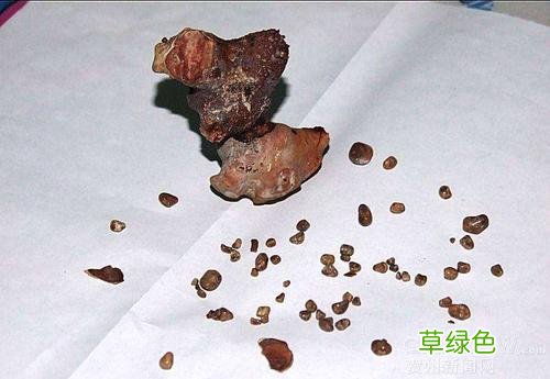肾结石的食疗方法有什么 肾结石的食疗方法