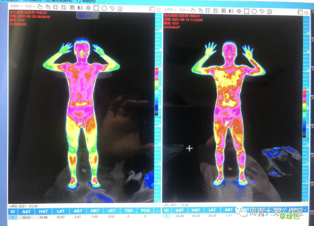 男科治疗一般多少钱 男科治疗