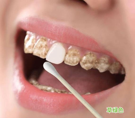 美白牙齿有什么危害 美白牙齿用什么好