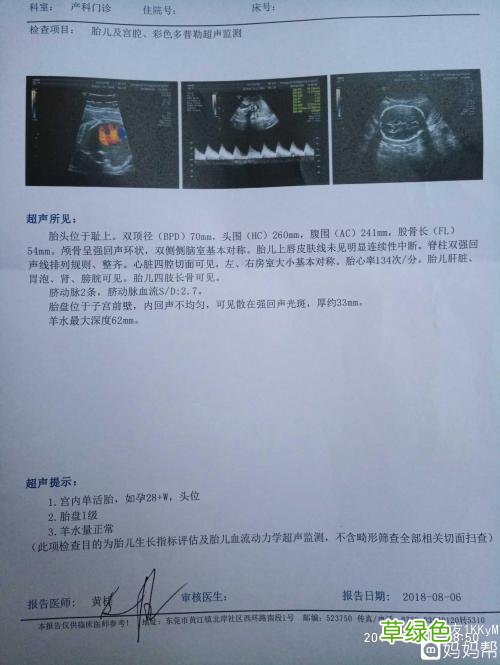 孕28周产检发报告音乐