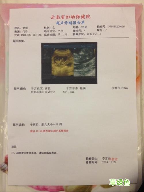 孕28周产检发报告音乐