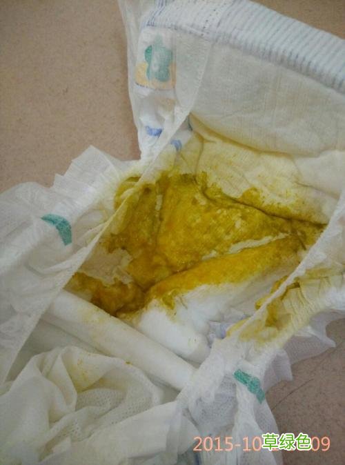 拉完大便后肛周痒有一年左右