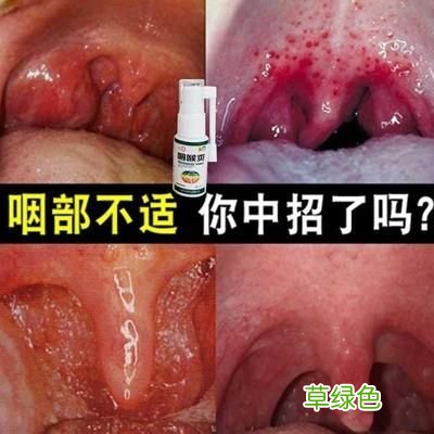 扁桃体发炎停药一天反复 扁桃体停药一天又发炎