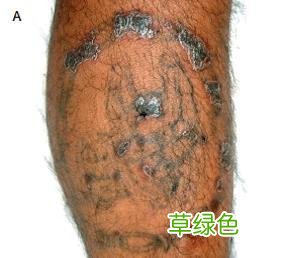纹身不干净会得什么病 纹身会转播什么病