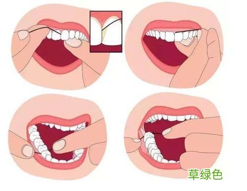 牙钳握持手法 牙线