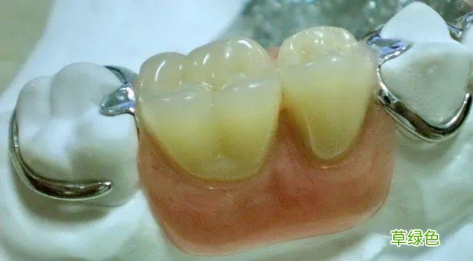 塑料假牙怎么清洗 假牙清洁