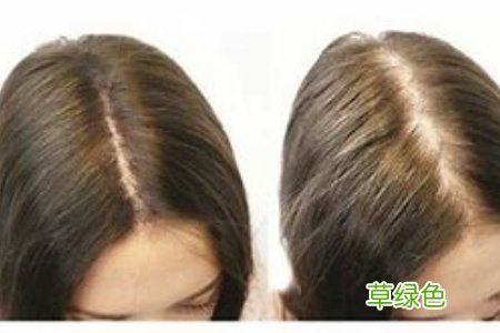 油性头发防脱发-预防脱发的洗剂