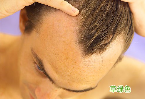 西安脱发去哪看-脱发严重老放屁